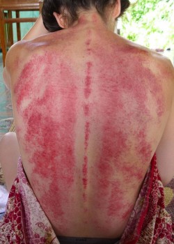 Massage Gua Sha Thaï Bruxelles : traitement n°1 Detox Générale Tabac, personne fumeuse.