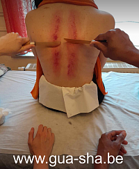 Massage gua sha thaï - cours module de base - Bruxelles - Belgique