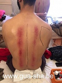 Cours Formation Massage Gua Sha thaï Module de base à Bruxelles - Belgique
