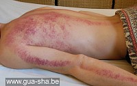 Massage gua sha thaï - Bruxelles - Belgique
